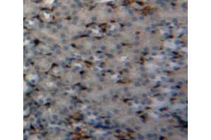 Used in DAB staining on fromalin fixed paraffin-embedded kidney tissue