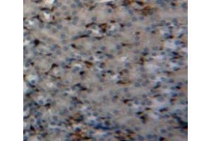 Used in DAB staining on fromalin fixed paraffin-embedded kidney tissue (PIN1 anticorps  (AA 2-165))