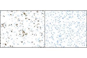 Immunocytochemistry (ICC) image for anti-Fc Fragment of IgG, Low Affinity IIIa, Receptor (CD16a) (FCGR3A) (AA 204-254) antibody (ABIN7449424)