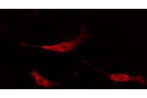 ABIN6267670 staining NIH-3T3 cells by IF/ICC. (TRKB anticorps  (pTyr706))