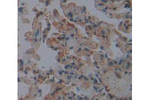 IHC-P analysis of Human Tissue, with DAB staining. (FGL2 anticorps  (AA 24-439))