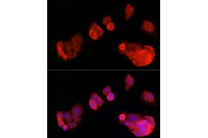 Immunofluorescence analysis of HepG2 cells using OP antibody (ABIN6129426, ABIN6145031, ABIN6145032 and ABIN6225150) at dilution of 1:100 (40x lens).