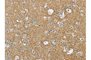 The image on the left is immunohistochemistry of paraffin-embedded Human brain tissue using ABIN7193008(VAMP2 Antibody) at dilution 1/20, on the right is treated with synthetic peptide.