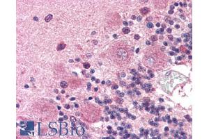 Image no. 1 for anti-Solute Carrier Family 9, Subfamily A (NHE9, Cation Proton Antiporter 9), Member 9 (SLC9A9) (C-Term) antibody (ABIN959586)