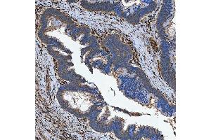 IHC analysis of SEMA4F using anti-SEMA4F antibody (ABIN7601432).