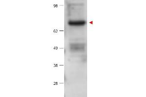 Image no. 1 for anti-Protein Kinase C, beta (PRKCB) (Internal Region) antibody (ABIN401432) (PKC beta anticorps  (Internal Region))