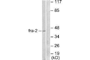 Western blot analysis of extracts from LOVO cells, using Fra-2 antibody (#C0197).