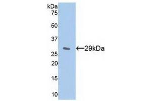 Detection of Recombinant IkBe, Human using Polyclonal Antibody to Inhibitory Subunit Of NF Kappa B Epsilon (IkBe) (Inhibitory Subunit of NF-KappaB epsilon (AA 207-440) anticorps)
