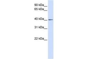 Image no. 1 for anti-NK3 Homeobox 2 (NKX3-2) (AA 180-229) antibody (ABIN6741422) (NKX3-2 anticorps  (AA 180-229))