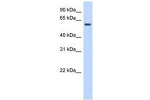 Image no. 1 for anti-Kelch-Like Family Member 42 (KLHL42) (AA 395-444) antibody (ABIN6741106) (KLHDC5 anticorps  (AA 395-444))