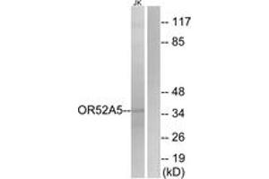 Western Blotting (WB) image for anti-Olfactory Receptor 52A5 (OR52A5) (AA 160-209) antibody (ABIN2891125) (OR52A5 anticorps  (AA 160-209))