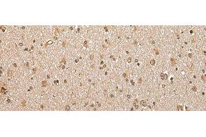 anti-Abhydrolase Domain Containing 14B (ABHD14B) antibody