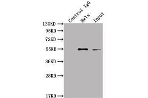 Immunoprecipitating ILK in Hela whole cell lysate Lane 1: Rabbit control IgG instead of ABIN7127572 in Hela whole cell lysate. (Recombinant ILK anticorps)