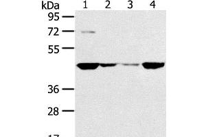 Western Blot analysis of HT-29, 231, hela and A549 cell using SMYD5 Polyclonal Antibody at dilution of 1:200 (SMYD5 anticorps)