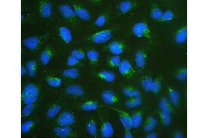 anti-Ribosomal Protein SA (RPSA) (AA 2-138) antibody