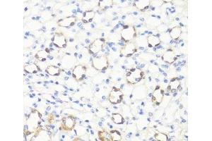 Immunohistochemistry of paraffin-embedded Mouse kidney using SS18L1 Polyclonal Antibody at dilution of 1:100 (40x lens). (SS18L1 anticorps)