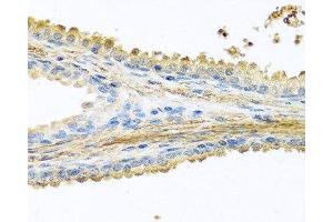 Immunohistochemistry of paraffin-embedded Human prostate using PIP Polyclonal Antibody at dilution of 1:100 (40x lens). (PIP anticorps)