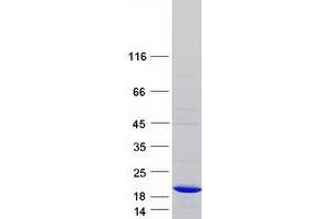 Validation with Western Blot