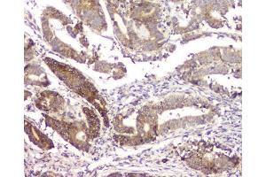 IHC analysis of RMI2 using anti-RMI2 antibody (ABIN6719656). (RMI2 anticorps)
