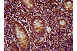 anti-WD Repeat Domain 37 (WDR37) (AA 1-496) antibody