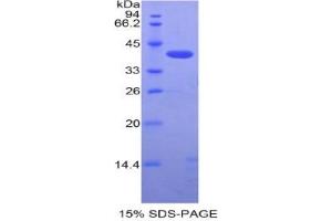 SDS-PAGE analysis of Mouse SIGIRR Protein. (SIGIRR Protéine)