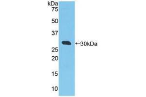 Western blot analysis of recombinant Human RIG1. (DDX58 anticorps  (AA 550-776))