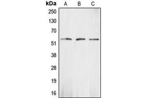 Western blot analysis of CHK1 expression in HeLa (A), mouse kidney (B), rat heart (C) whole cell lysates.