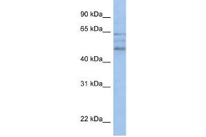WB Suggested Anti-ZMYND17 Antibody Titration:  0. (ZMYND17 anticorps  (C-Term))