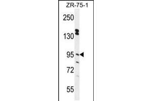 Western blot analysis in ZR-75-1 cell line lysates (35ug/lane). (ERMP1 anticorps  (C-Term))
