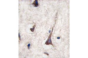 Formalin-fixed and paraffin-embedded human brain tissue reacted with CD3G antibody , which was peroxidase-conjugated to the secondary antibody, followed by DAB staining.
