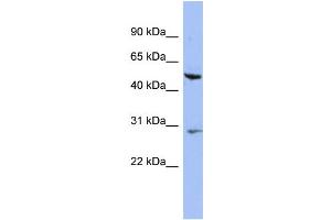 WB Suggested Anti-KRT75 Antibody Titration: 0. (Keratin 75 anticorps  (N-Term))