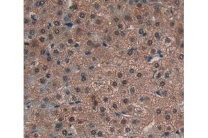 Used in DAB staining on fromalin fixed paraffin- embedded liver tissue