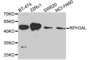 Western blot analysis of extracts of various cell lines, using RPH3AL antibody. (RPH3AL anticorps  (AA 161-315))