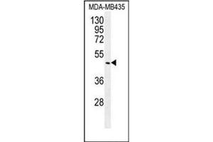 Western blot analysis of BMP14 / GDF5 Antibody (C-term) in MDA-MB435 cell line lysates (35ug/lane). (GDF5 anticorps  (C-Term))