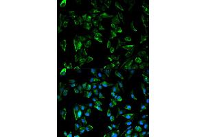 Immunofluorescence analysis of HeLa cells using TPM3 antibody (ABIN5970548). (TPM3 anticorps)