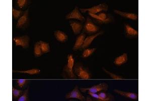 Immunofluorescence analysis of U-2 OS cells using PDE6D Polyclonal Antibody at dilution of 1:100 (40x lens). (PDE6D anticorps)