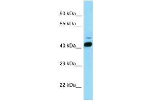 WB Suggested Anti-Rorb Antibody   Titration: 1. (RORB anticorps  (N-Term))