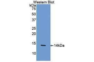 Western blot analysis of the recombinant protein. (CCL4 anticorps  (AA 24-92))
