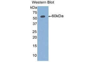 Western Blotting (WB) image for anti-Aldehyde Dehydrogenase 7 Family, Member A1 (ALDH7A1) (AA 1-539) antibody (ABIN1077759) (ALDH7A1 anticorps  (AA 1-539))