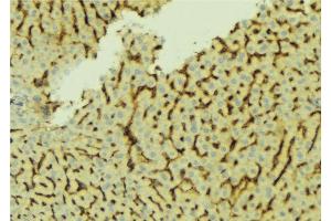 ABIN6276661 at 1/100 staining Mouse liver tissue by IHC-P. (CETP anticorps)