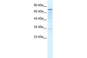 WB Suggested Anti-FLJ20244 Antibody Titration:  2. (TRMT1 anticorps  (Middle Region))