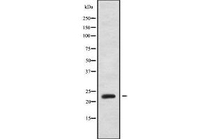 Western blot analysis of PPP1R2P3 using MCF7 whole cell lysates (PPP1R2P3 anticorps)