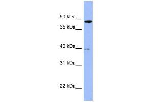 WB Suggested Anti-RDX Antibody Titration: 0. (Radixin anticorps  (Middle Region))