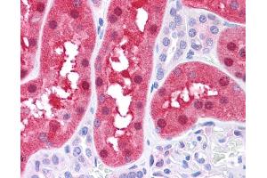 FAH antibody was used for immunohistochemistry at a concentration of 4-8 ug/ml. (FAH anticorps)