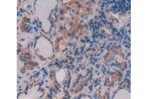 Used in DAB staining on fromalin fixed paraffin- embedded thyroid tissue (ABCB9 anticorps  (AA 504-766))