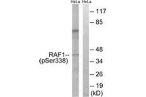Western blot analysis of extracts from HeLa cells treated with paclitaxel 1uM 24h, using C-RAF (Phospho-Ser338) Antibody. (RAF1 anticorps  (pSer338))