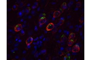 Immunostaining of a PFA fixed formic acid treated brain section from an triple transgenic Alzheimer mouse with anti-APP (dilution 1 : 200; red) and biotinylated mouse anti-Abeta (cat.