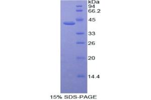 SDS-PAGE analysis of Human ACVR2A Protein. (ACVR2A Protéine)