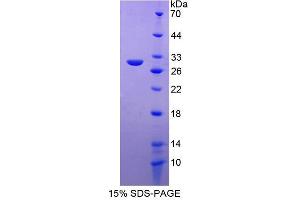 Image no. 1 for Progesterone Immunomodulatory Binding Factor 1 (PIBF1) (AA 13-203) protein (His tag) (ABIN4991016)