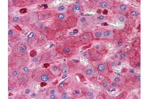 Immunohistochemical analysis of paraffin-embedded human Liver tissues using RTN3 antibody (Reticulon 3 anticorps)